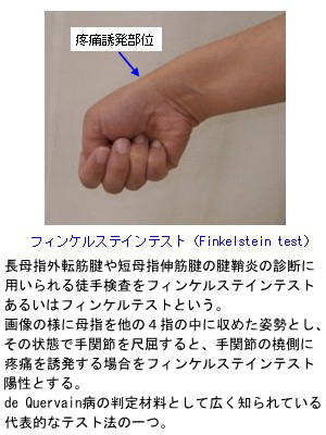 b>手首の痛み< b>習志野の整体 医師も推薦 大久保接骨院