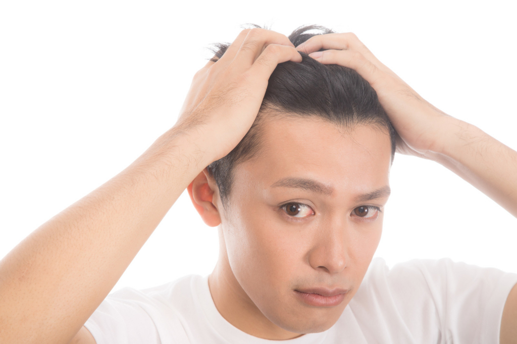はげ薄毛 薄毛が目立たない理想のヘアスタイルに大変身