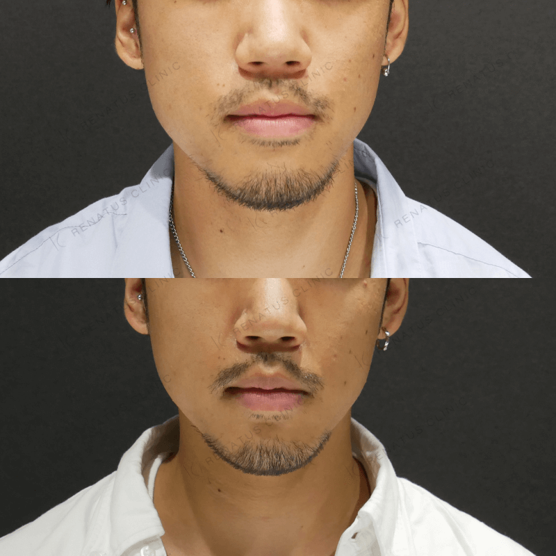 ふさふさした口ひげは素晴らしい。髭の生えた髭の髭の男。髭の生えた毛を剃らない顔に生えた残忍なヒッスター。グレイの壁に長いひげと口ひげを生やした真面目な男。写真素材1510051832Shutterstock