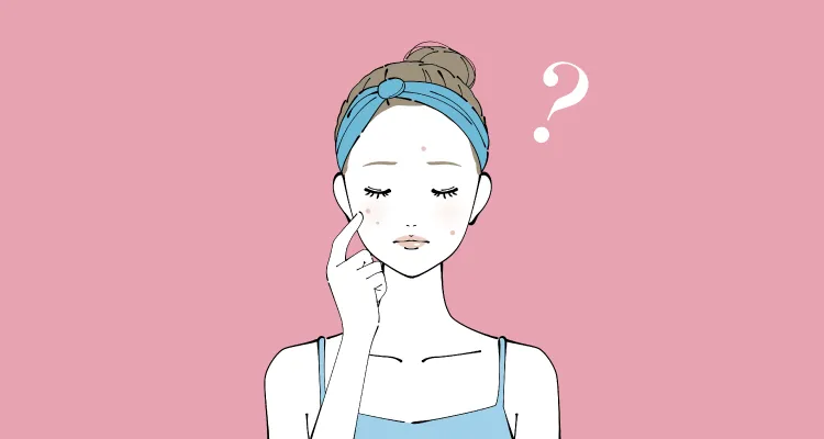 ニキビ占いとは？ 顔と体の部位別で分かる意味と運勢27選「マイナビウーマン」