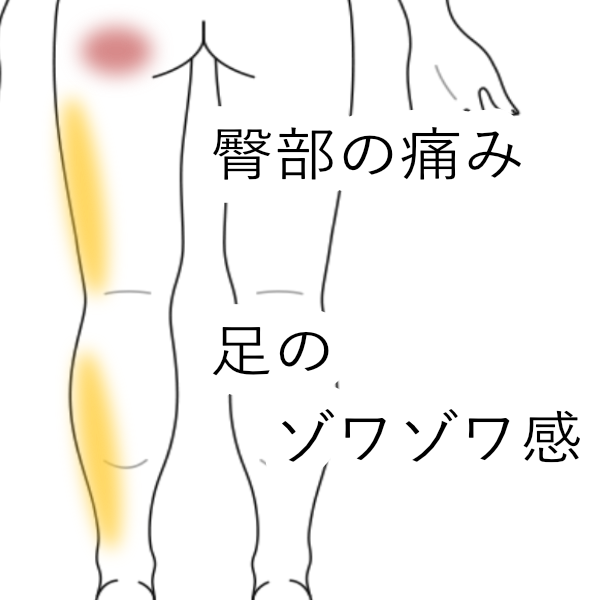 腰痛・坐骨神経痛症例19 60代女性 左お尻がいつも痛い 特に朝椎間板ヘルニアと診断された湯沢の整体 女性院長で安心 コスモス自然形体院