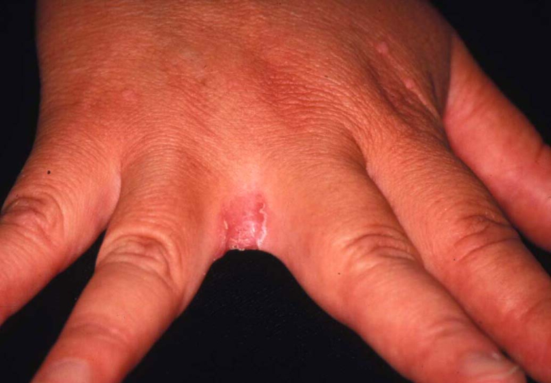 手をつないで伝える元気の力 2017 02 12病気の子どもたちに、入院中でも学習や体験の場を提供したい！ 三好祐也 認定NPO法人ポケットサポート代表理事- クラウドファンディング READYFOR