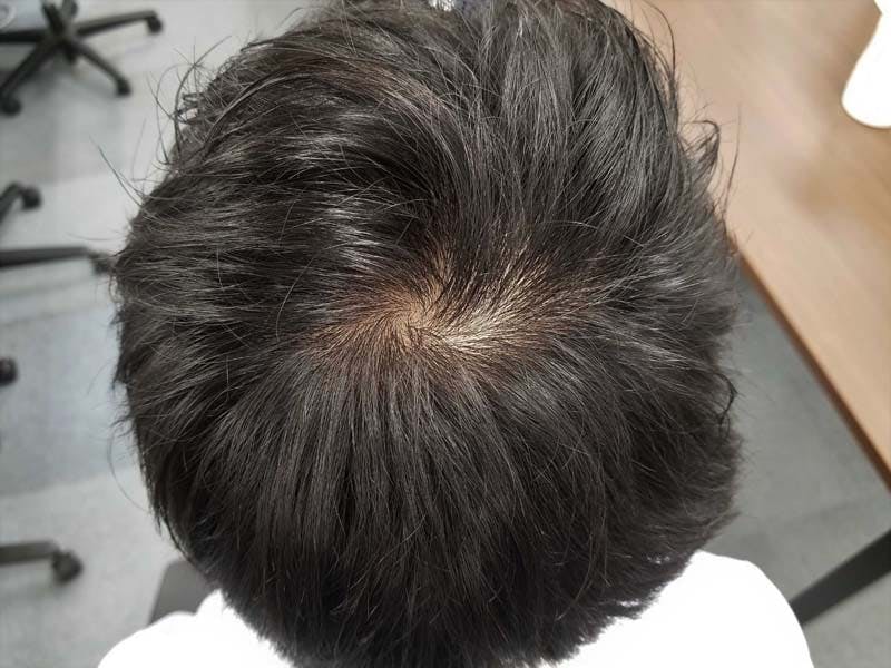 男子高校生です。 - つむじハゲてませんか？ - Yahoo!知恵袋