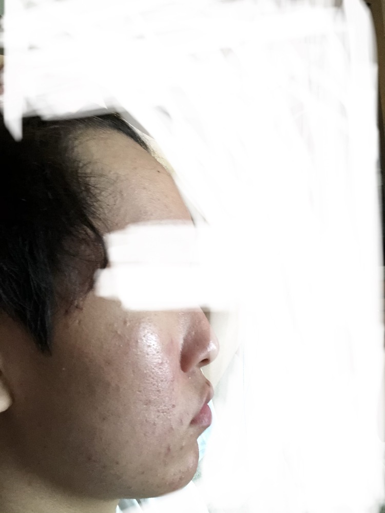 平面顔を治して美しい横顔を手に入れよう！平面顔を目立たなくする方法やパーツの位置を調整する美容整形をご紹介！公式コラム美容整形・二重整形なら共立美容外科