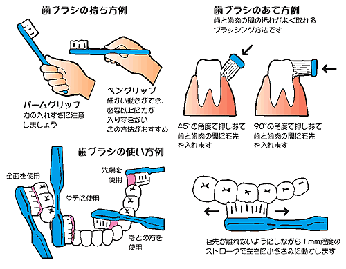 健康な白い歯への第一歩：正しい歯磨きのテクニック」阿倍野区昭和町駅の歯医者 ひだまり歯科