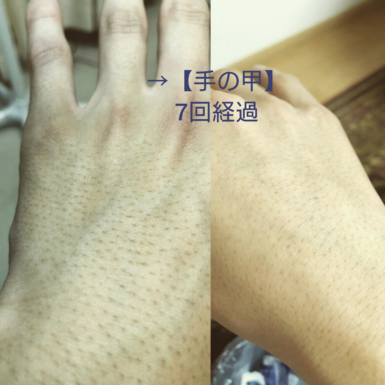 うっすらはえてる手のムダ毛。ハンドクリームで保湿しながら薄くできるかも!?ミモレ編集部のリレー連載 今日のお助けコスメmi-mollet ミモレ明日の私へ、小さな一歩