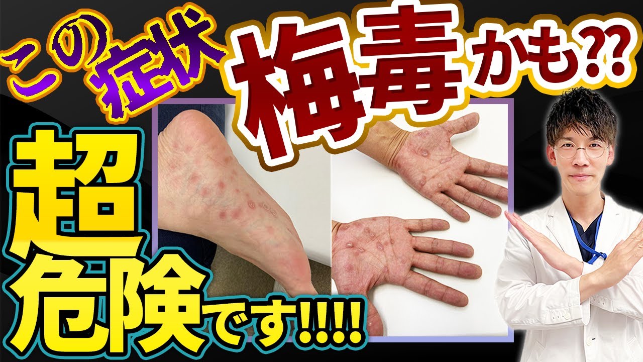 性病・水前寺皮フ科医院熊本市の皮膚科・形成外科・アレルギー科