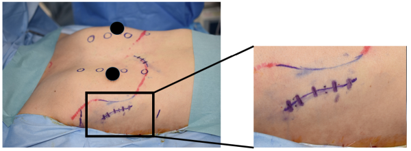 図解 縫合の基本 Part1 皮膚縫合Antaa Slide