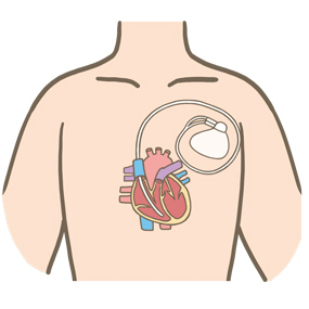 不整脈グループ - 兵庫医科大学 循環器内科