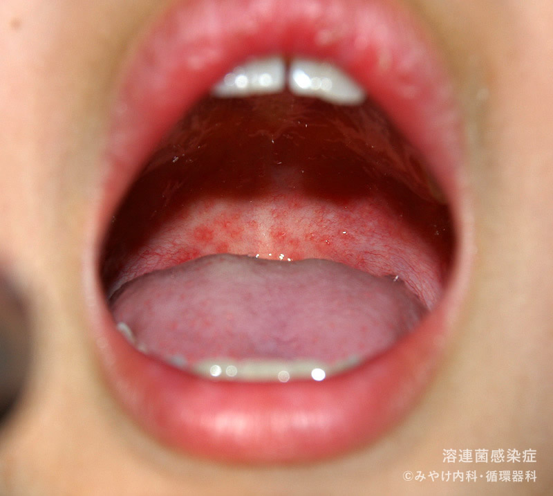 見てわかるのどの病気 耳鼻咽喉科内藤クリニック