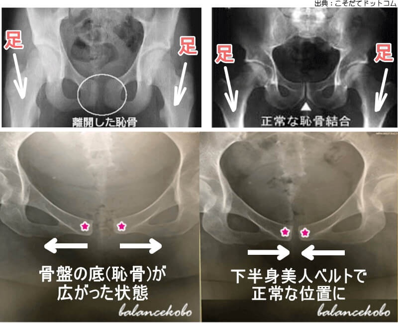 胸のレントゲン写真で心臓の大きさを測ってみよう！ – みどり病院神戸市、明石市、循環器、透析