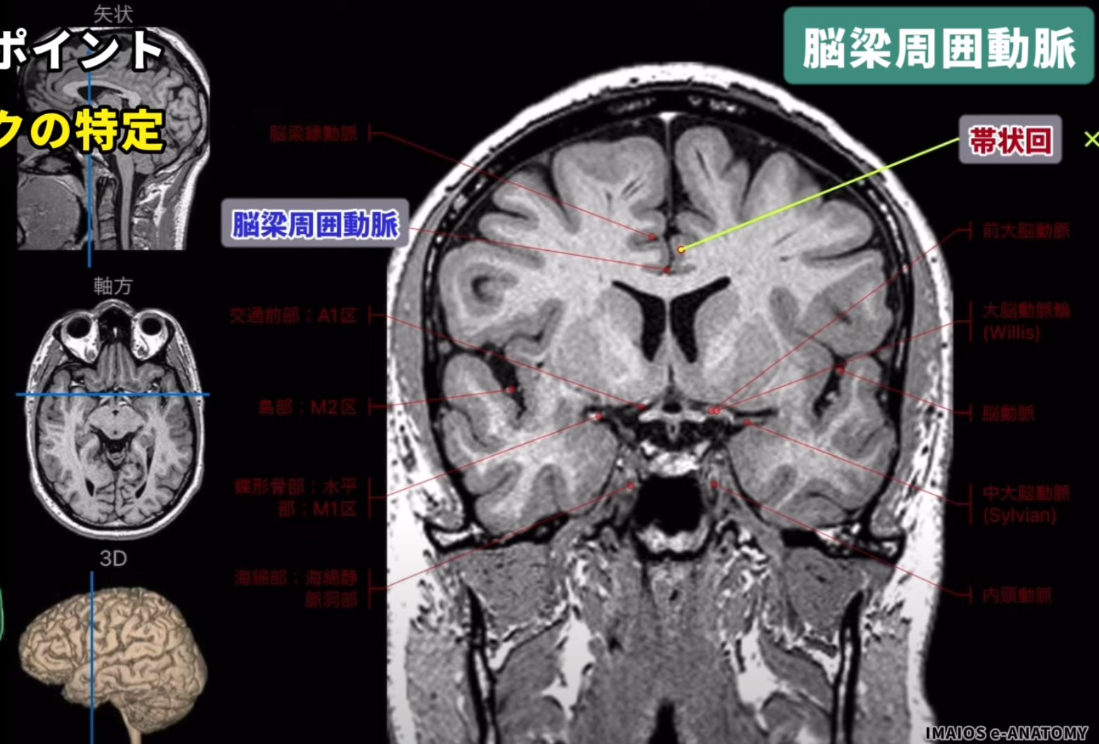 舌状回線維 - e-Anatomy - IMAIOS