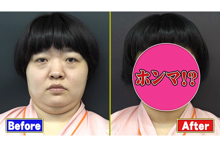 整形は顔をきれいにするだけではない？―韓国の人気TVで検証 - WSJ