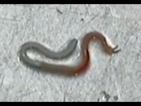 アニサキスって、いったい何者なんですか？一般社団法人 アニサキスアレルギー協会