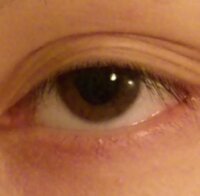 三重まぶたの治し方は？マッサージやアイテープで改善できる？三重になる原因や予防についても解説