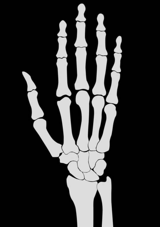 腱鞘炎間庭整形外科