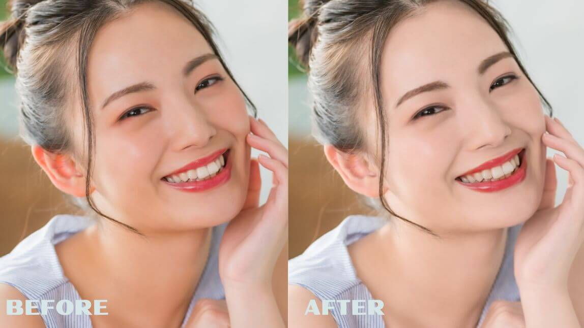 肌を白くする方法と生活習慣の見直しと正しいスキンケア方法を医師が解説公式コラム美容整形・二重整形なら共立美容外科