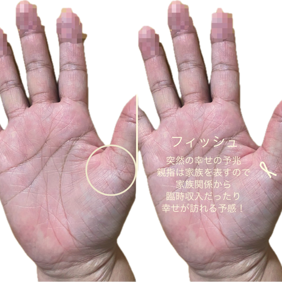 手相のフィッシュと島の見分け方について。 - 下図のような手相が運命線の- Yahoo!知恵袋