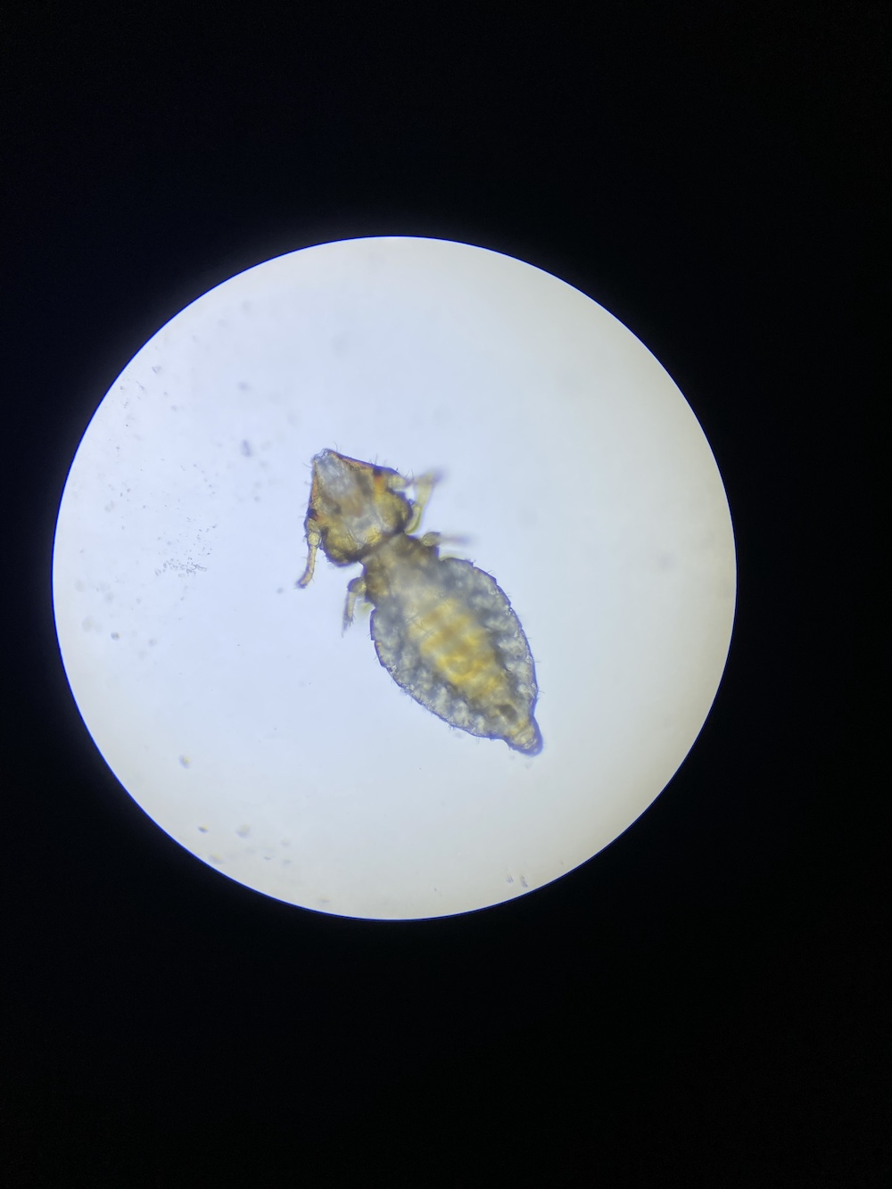 寄生虫館 イヌジラミ