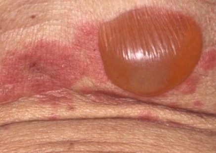 日本臨床皮膚科医会-ひふの病気