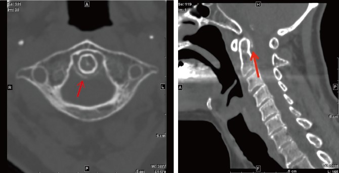 首の痛み西荻窪駅・久我山駅すぎなみ脳神経外科・しびれ・頭痛クリニック
