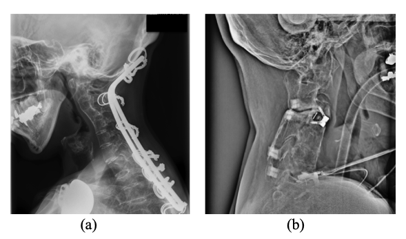 気管挿管、人工呼吸器をするという事相模原市中央区古淵周辺そらまめピアノ教室♪ブログ