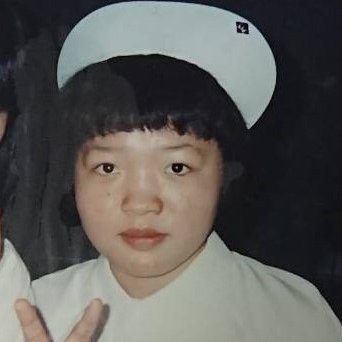 カリナのビジュ変遷。 平面顔から奥行き顔に変化。 👨‍⚕️各手術ごとの名医のご紹介はプロフィールのメールフォームからお気軽にどうぞ📩 .全切開鼻孔縁挙上ベラジェルモティバ表ハムラ輪郭2点人中短縮ボトックス鼻翼挙上目の下の切らない