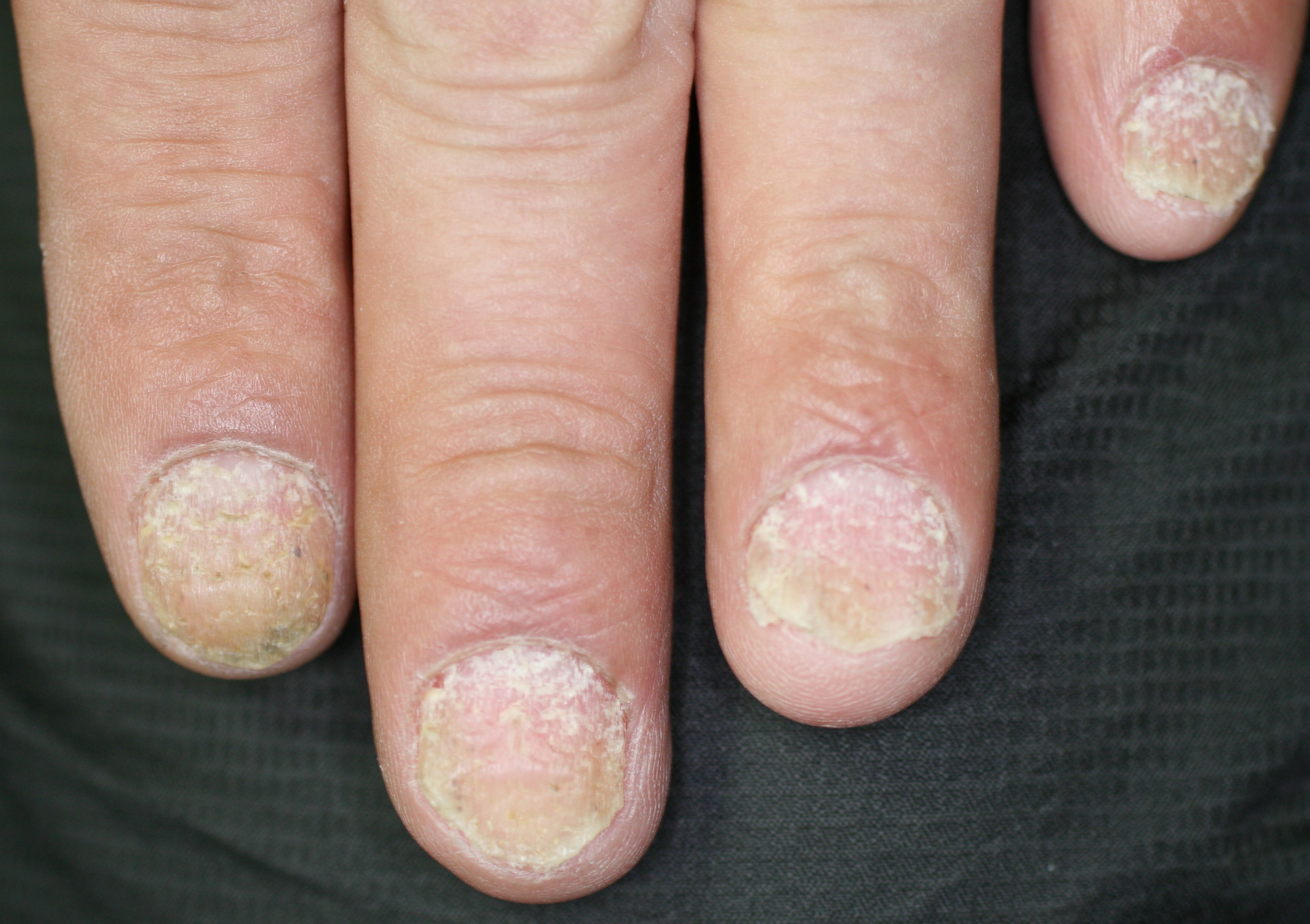 痒いの写真・画像素材-Snapmart スナップマート