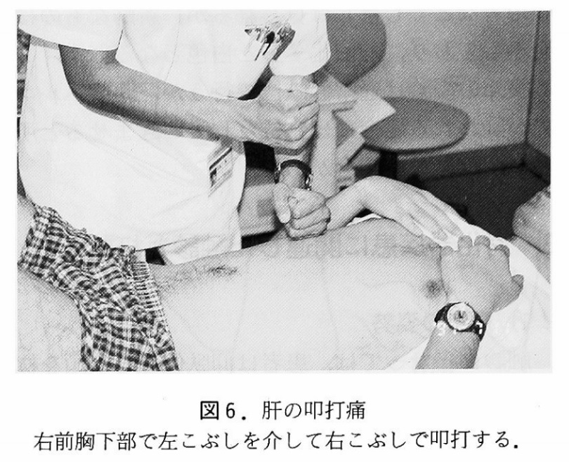 １分で伝えるER , 「乳児の窒息」, ⁡, 1歳未満の乳児が“窒息”したら, “背部叩打法”と“胸部突き上げ法”を, 交互に５回ずつ繰り返す,⁡, “意識がない”場合は, “心肺蘇生法”を行う, ⁡, ▶︎背部叩打法,赤ちゃんをおとなの太ももの上でうつ伏せにし、片方の手で顔を支えて、頭を胸よりも少し低い体勢にする,もう片方の手の付け根で、背中の真ん中を、連続して強く叩く, ⁡,