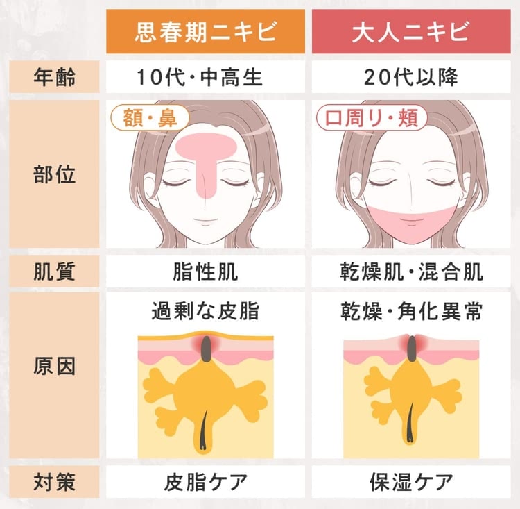 にきび肌のスキンケアで大切なことノブ公式ブランドサイト