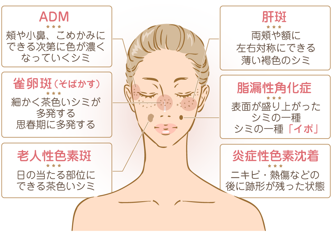 目の色素沈着は遺伝？アレルギー？神戸市東灘区エステコラム東灘・住吉駅のサロンドエルサ