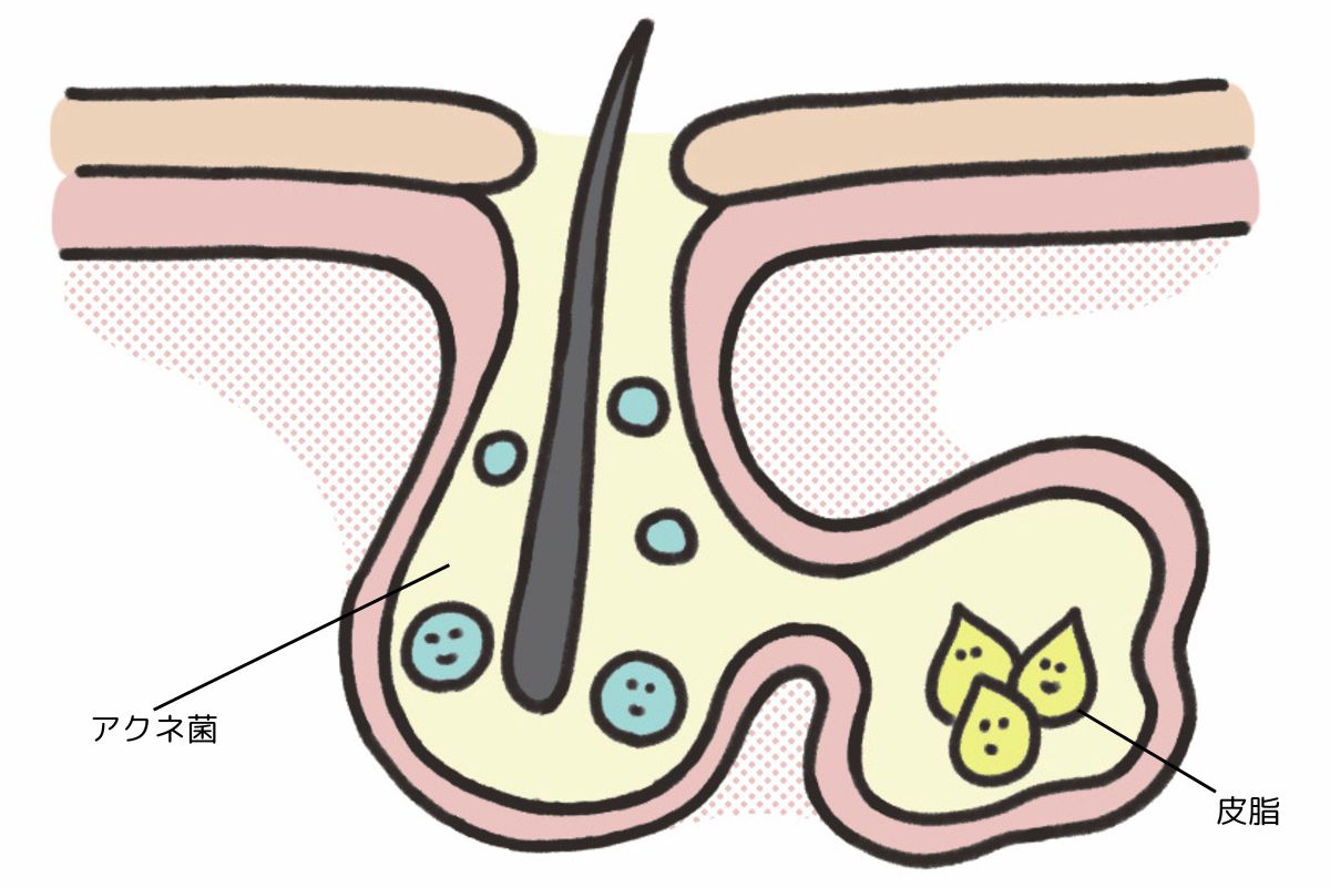 角栓、毛穴悩みよバイバイ。エディターの肌を変えたクレンザーとは？ エディターの推しコスメVogue Japan