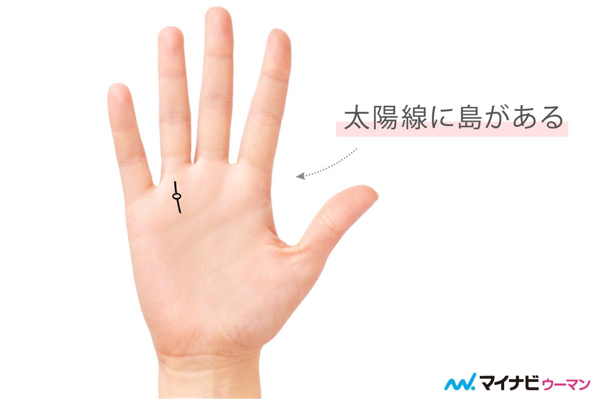 手相から読み解く体と心のヒント：西洋医学と漢方の視点加納渡辺病院 岐阜市 乳腺外来・痔核手術・内視鏡・漢方外来