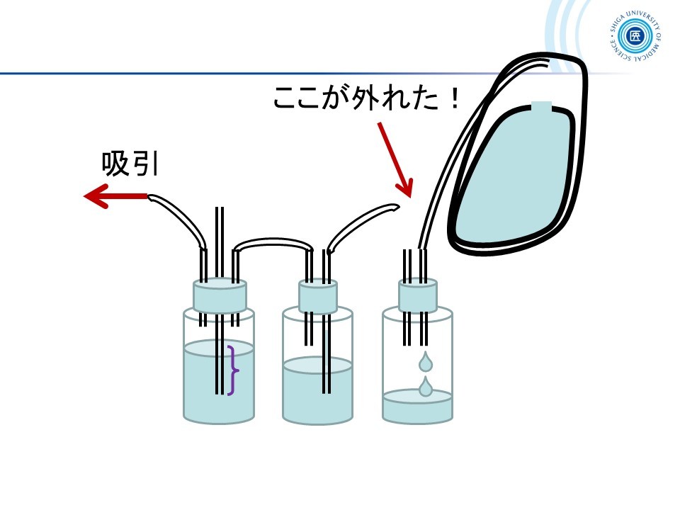 7-1190-01 処置キット黄バッグ 胸腔ドレナージ DMAT用ディスポ鉗子セット1セット 黄バッグ 胸腔ドレナージAXELアズワン
