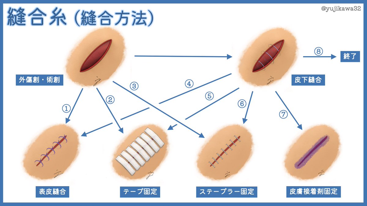 傷の縫い方美容外科話美容外科、美容整形修正の名医は東京新宿の山本クリニック
