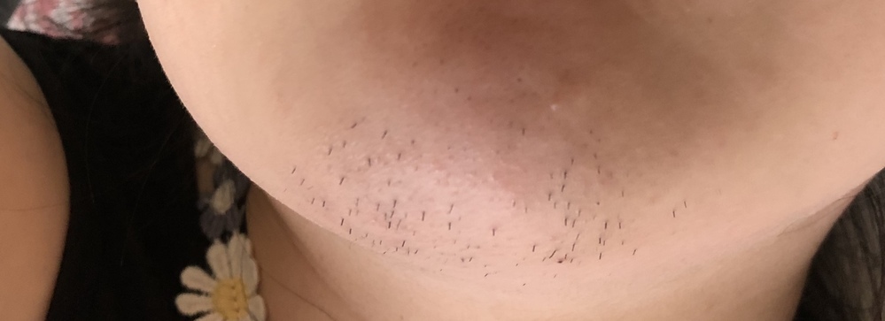 女性の口ひげ剃り方ガイド