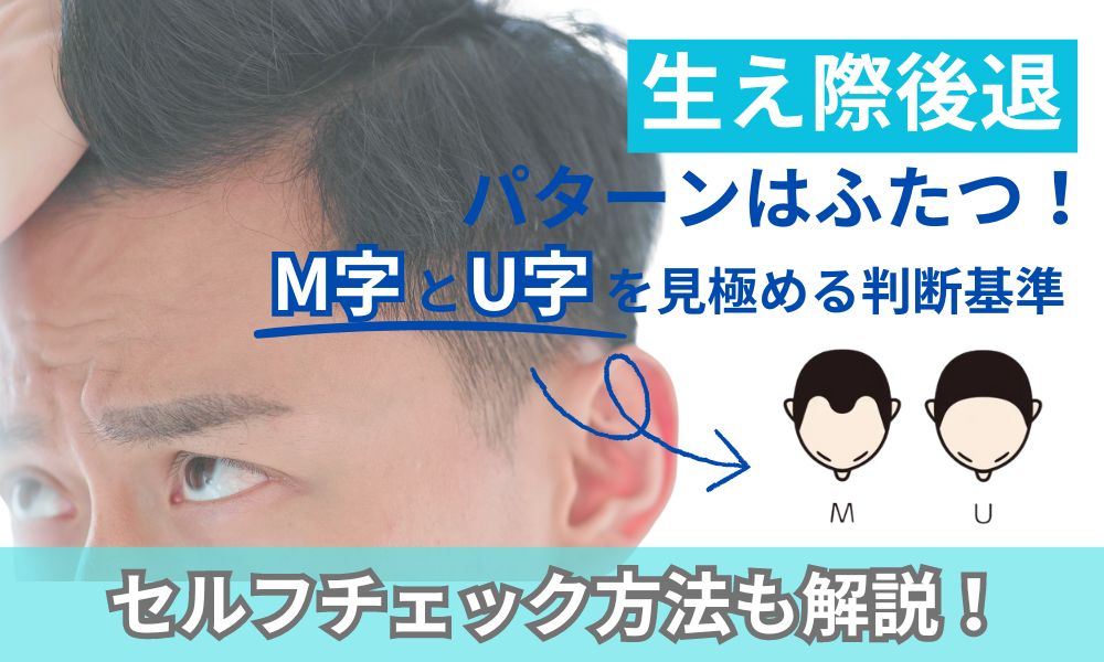 ハゲは生き様薄毛を個性にする男たちのスタイルカタログNOHAIRS