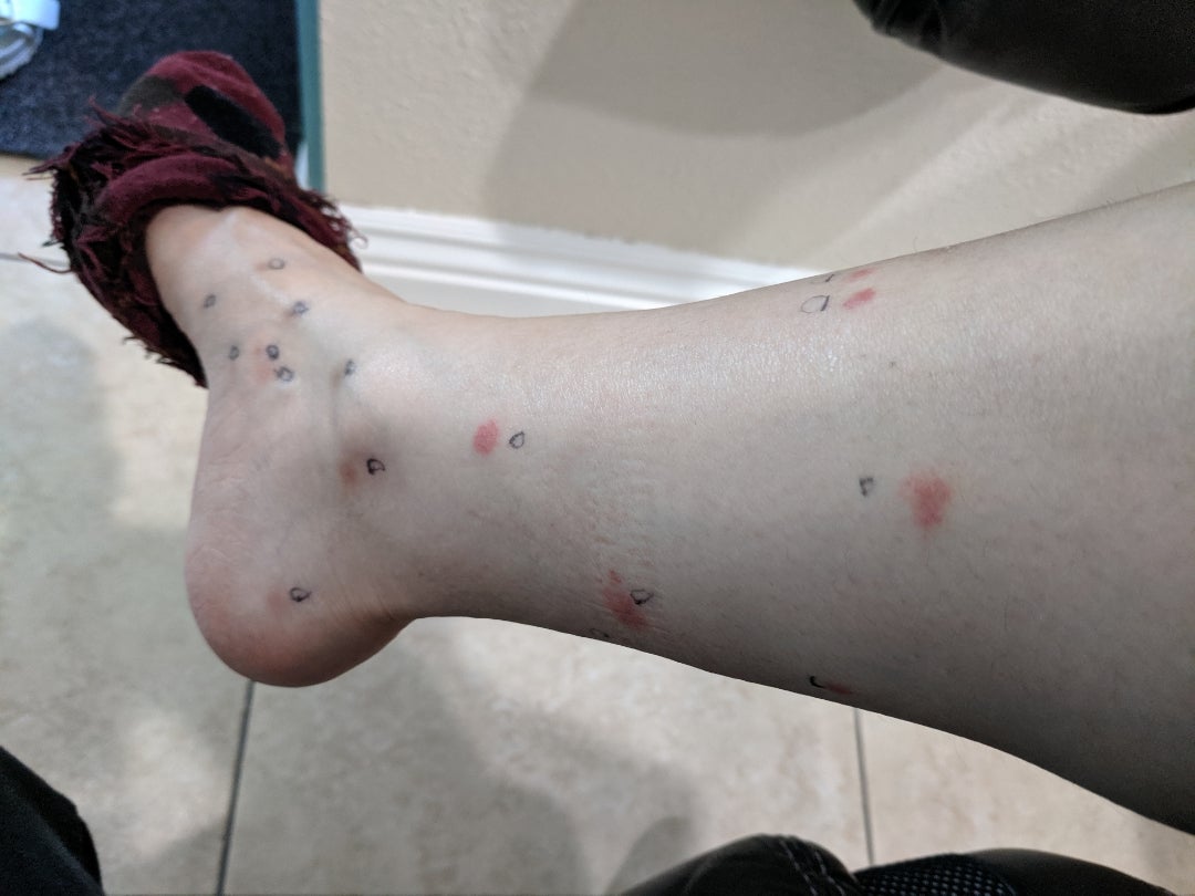 ノミ・ダニ予防 - つばさ動物病院 大田区 洗足池 トリミング