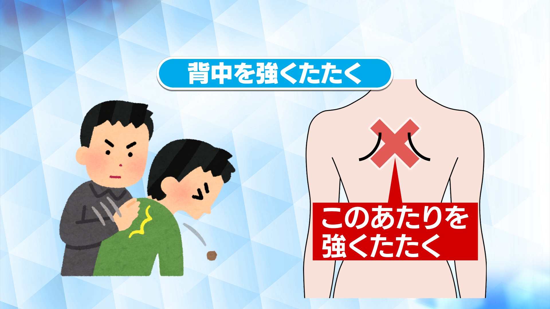 実は｢揉む｣｢叩く｣は意味がなかった バキバキに固まった肩､腰の痛みに名医が実践する｢エックスの法則｣とは人間の体はじっとしているのに適した構造ではない3ページ目PRESIDENT Online プレジデントオンライン