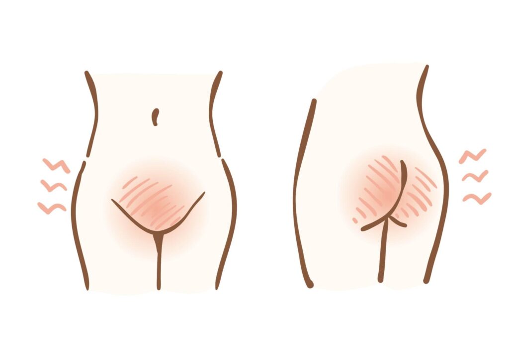 陰部 女性 のできもの・しこりの原因と検査、治療薬 画像あり 天神マイケアクリニック