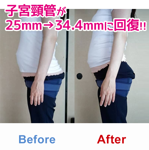 トコちゃんベルトとは トコちゃんベルト正規販売店 ぴっぴちゃんランド