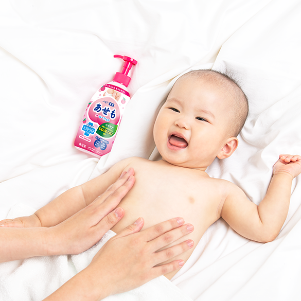 専門医が解説 赤ちゃんの「汗・あせも」の予防策！頭の汗の対処法は？ヘルメット治療ならスターバンドのAHS Japan