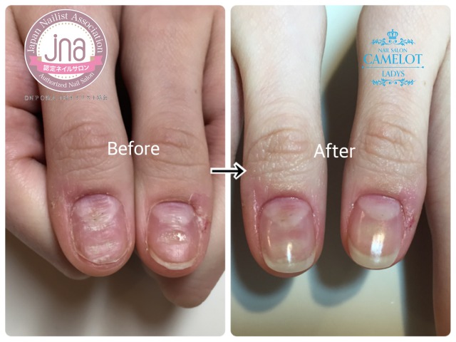 フット お客様 - nail salon SOLEILネイルサロン ソレイユ のネイルデザイン No.6774091 ネイルブック