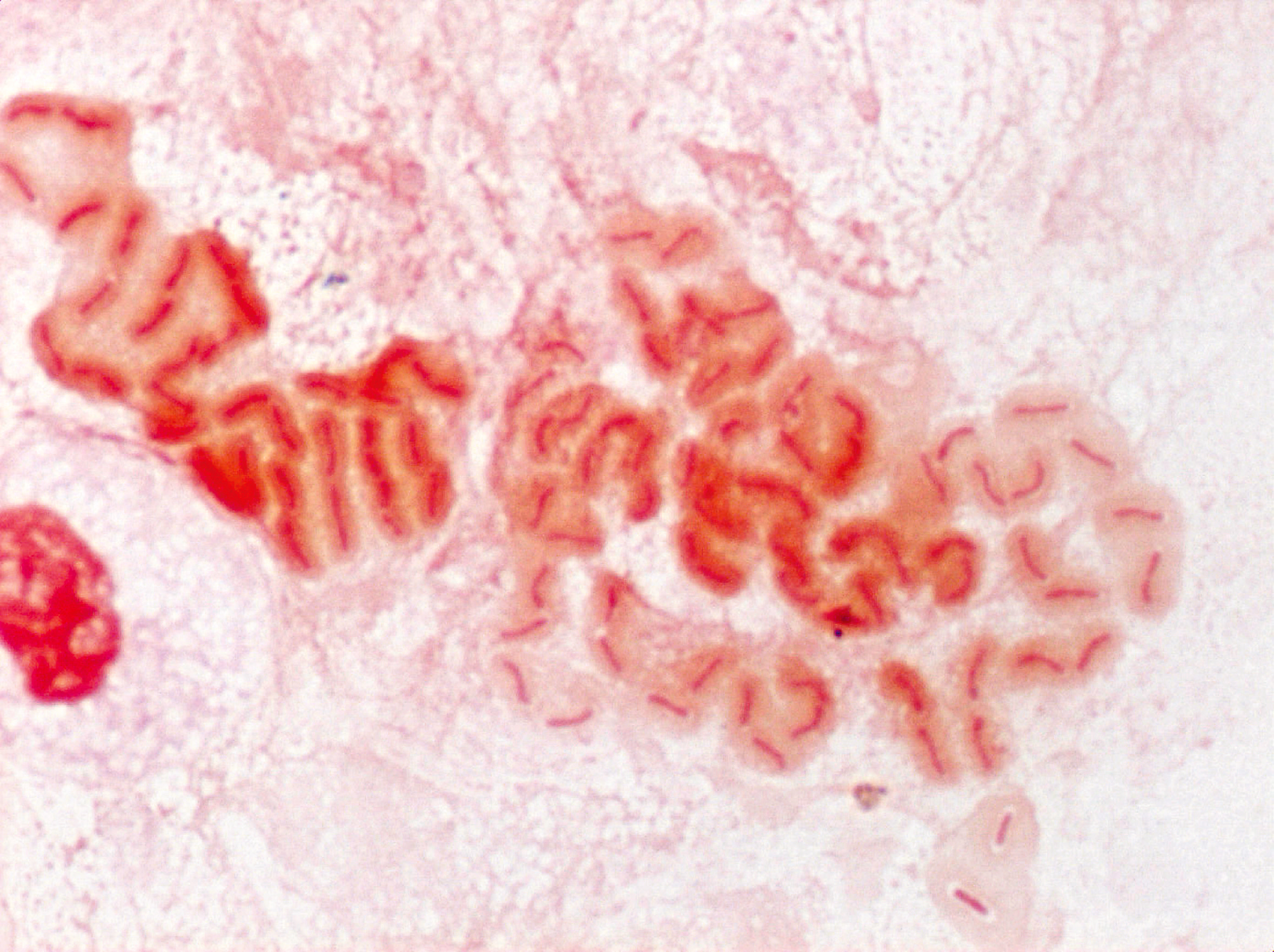 蜂窩織炎 手や足が腫れて痛い場合 ふじた医院 善通寺の整形外科・内科・リハビリテーション