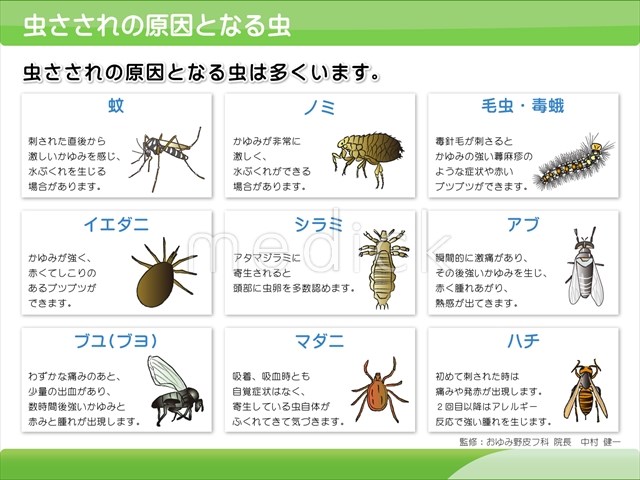 症例画像 虫刺されの症状・対処法 ひどい腫れや痒みも皮膚・爪・髪の病気All About