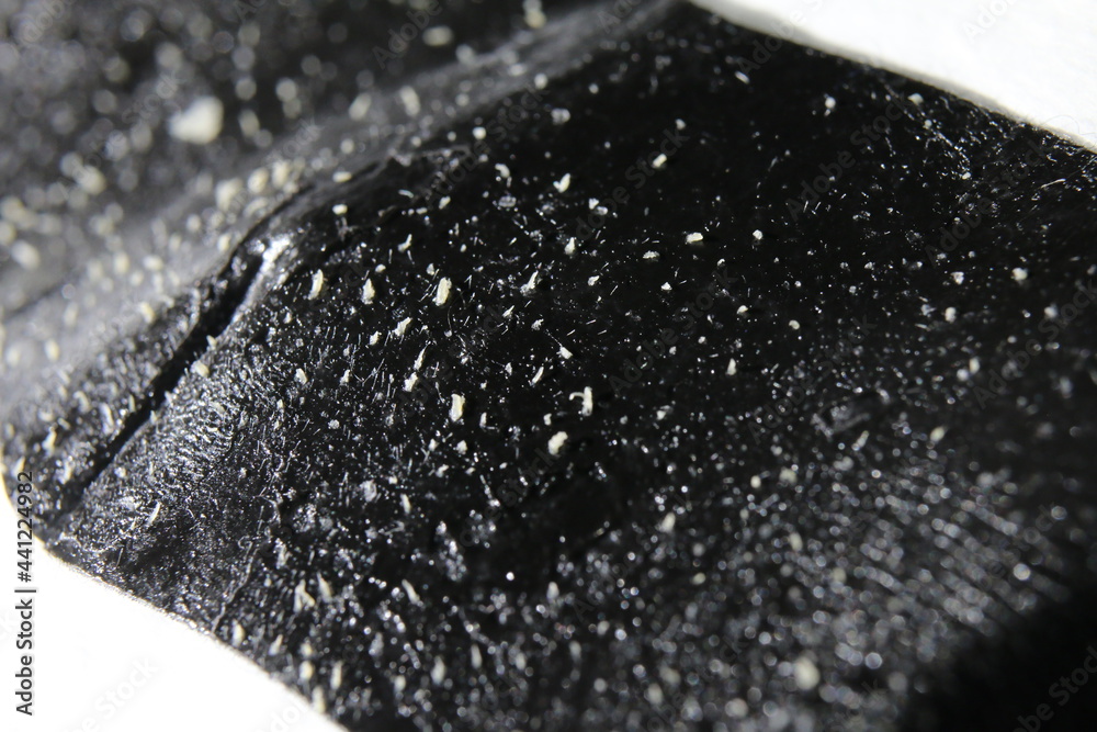 角栓」の3.1万点のロイヤリティフリー画像、写真素材、絵Shutterstock