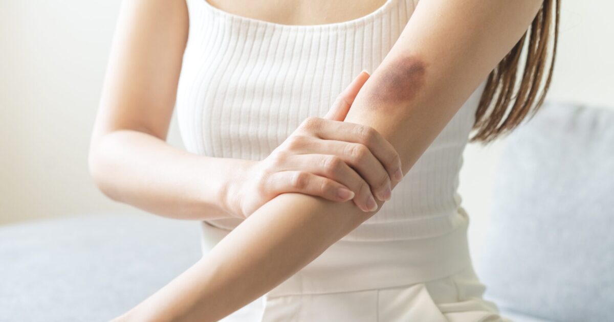 薬剤師が解説 「あおたん」におすすめの市販薬はどれ？9選を紹介 – EPARKくすりの窓口コラムヘルスケア情報