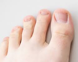 糖尿病と爪の関係爪の小さな異変も見逃すな！ドクターズチョイス健康情報集