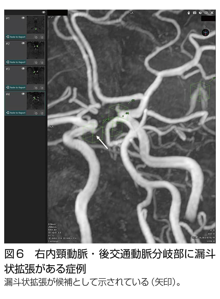 脳血管障害東京女子医科大学附属足立医療センター 脳神経外科