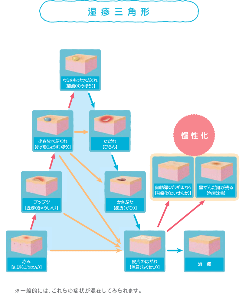 皮膚科保険診療一覧神戸市兵庫駅前ちさ皮フ科クリニック